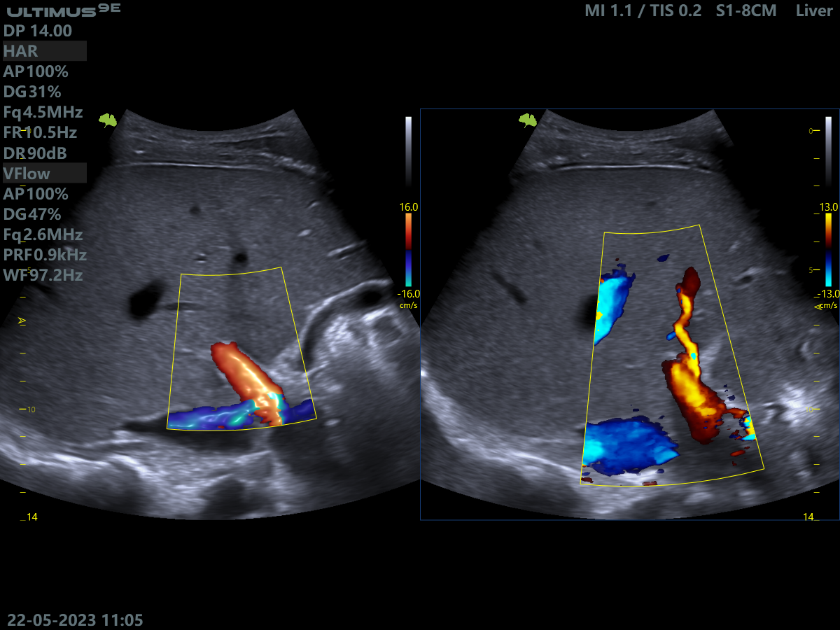 Клінічне зображення 1