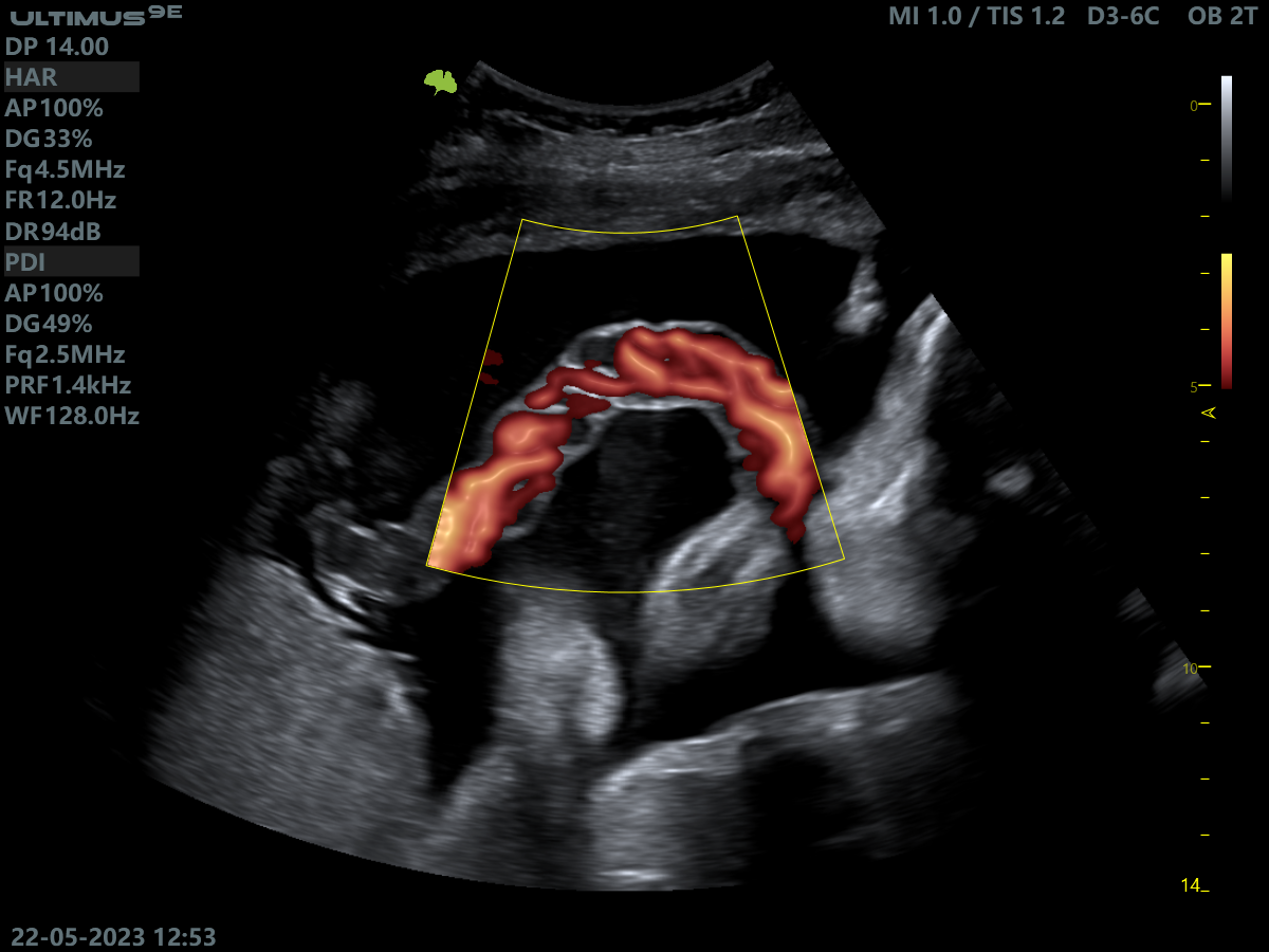 Клінічне зображення 3