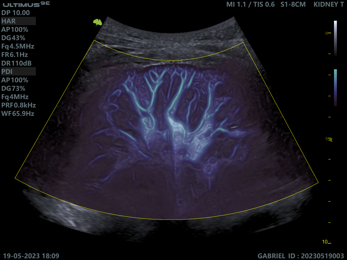 Клінічне зображення 4