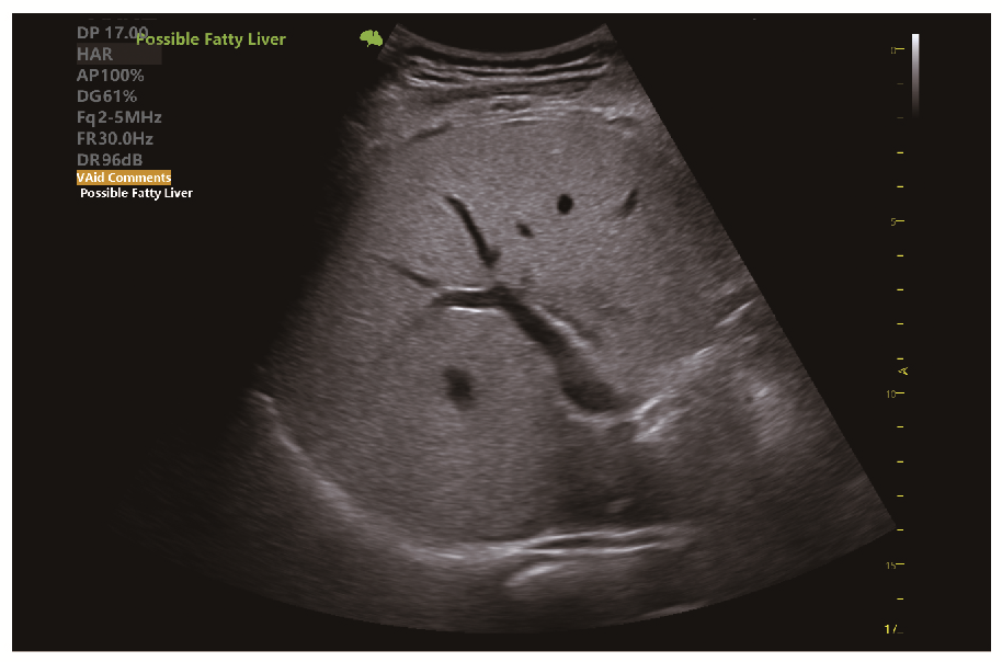 Клінічне зображення 1