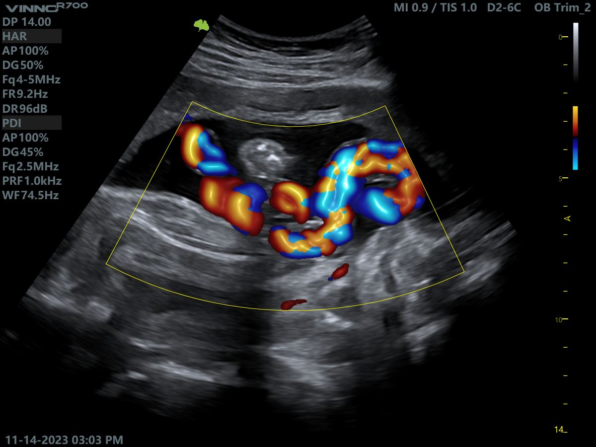 Клінічне зображення 2