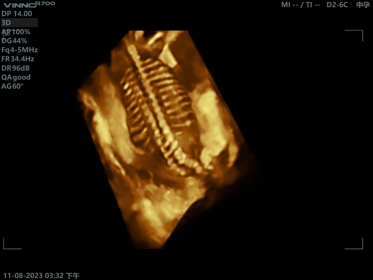 Клінічне зображення 4