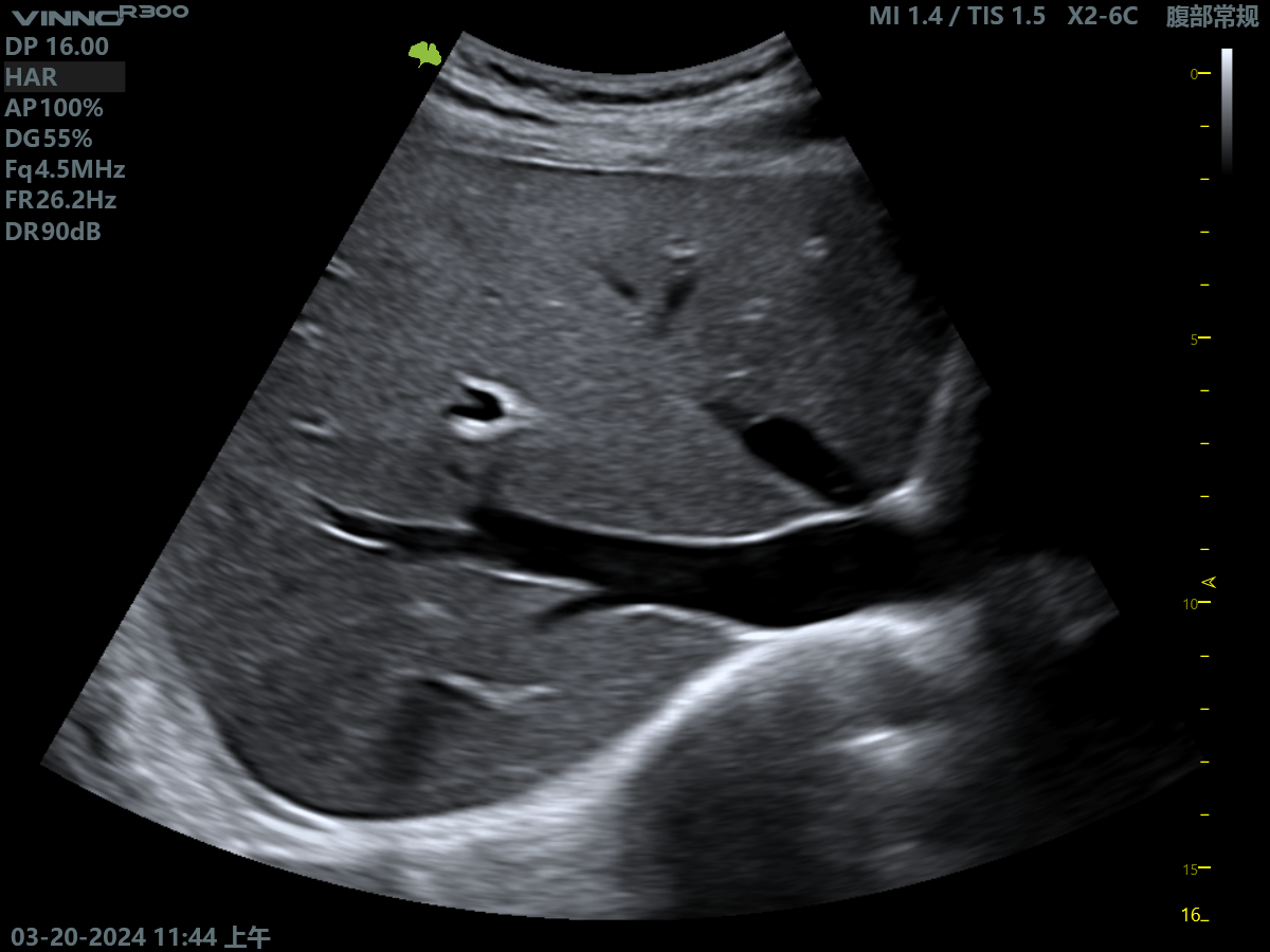 Клінічне зображення 1