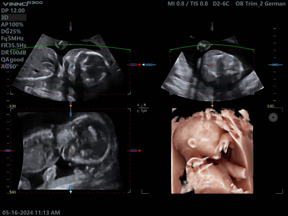 Клінічне зображення 4