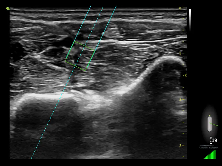 Клінічне зображення 1