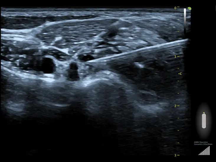 Клінічне зображення 2